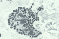 Mastocyte