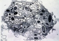 Coupe de macrophage ayant phagocyté un grand nombre de bactéries.