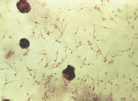 Sporozoïtes de Plasmodium