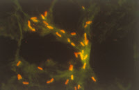 Mouvement intracellulaire de Shigella flexneri