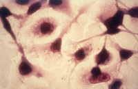 Macrophage infecté par Listeria monocytogenes