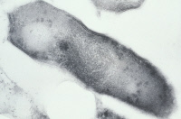 Mycobacterium leprae en microscopie électronique à transmission.