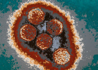 Virus Herpes simplex