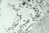 Cellules infectées par le virus Ebola