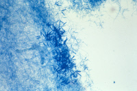 Microsporum vanbreusghemii