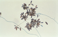 Curvularia senegalensis