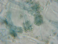 Penicillium roquefortii