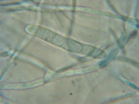 Trichophyton rubrum