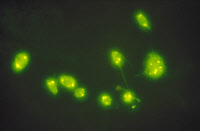 Visualisation par immunofluorescence de neurones infectés par le virus de la rage