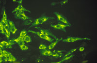 Visualisation par immunofluorescence de neurones infectés par le virus de la rage