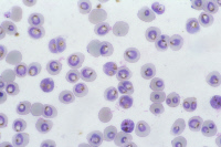 Globules rouges et Plasmodium falciparum