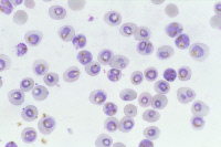 Globules rouges et Plasmodium falciparum
