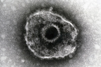 Virus de la varicelle-zona
