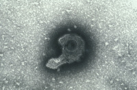 Virus de la varicelle-zona