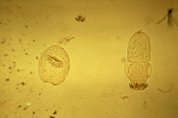 Scolex d'Echinococcus granulosus