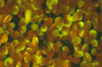 Cellules de chenille infectées par un Baculovirus recombinant