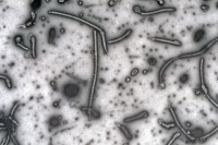 Virus Ebola (microscopie électronique à transmission)
