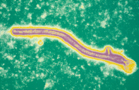 Virus Ebola. Microscopie électronique à transmission colorisée.