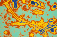 Virus Ebola. Microphotographie colorisée.