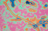 Virus Ebola. Microphotographie colorisée.
