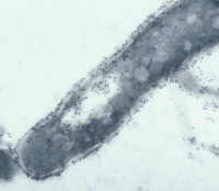 Détection d'une protéine excrétée à la surface de Mycobacterium tuberculosis