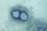 Virus Grippaux (microscopies électroniques)