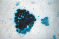 Infection par les rétrovirus recombinants lacZ