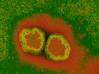 Virus de la grippe type A