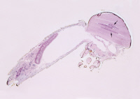 Larves de filaires de Bancroft dans thorax de moustique femelle