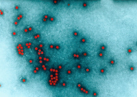 Poliovirus, agent de la poliomyélite. Image colorisée.