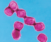 Virus de la variole en microscopie électronique à transmission