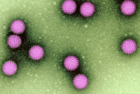 Rotavirus. Microscopie à transmission colorisée.