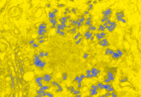 Virus de la rage fixe dans une cellule de cerveau de souris