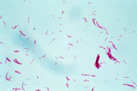 Bactéries Mycobacterium ulcerans