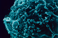 Virus VIH-1 à la surface d'un lymphocyte