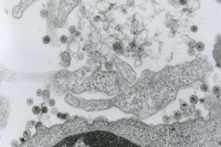 Lymphocyte T infecté par le Virus LAV (futur VIH) - photo 1983