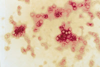 Virus de la dengue en microscopie électronique - fausses couleurs