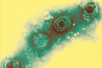 Cytomégalovirus
