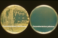 Cultures de Corynebacterium diphteriae et Corynebacterium jeikeium