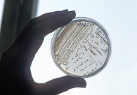 Vibrio cholerae sur gélose en boîte de pétri