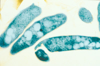Coupe de Mycobacterium bovis ou bacille de Calmette et Guérin (BCG)