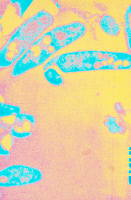 Coupe de Mycobacterium bovis ou bacille de Calmette et Guérin (BCG)