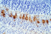 Bornavirus infectant des cellules de Purkinje