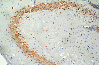 Cellules infectées par le virus West Nile
