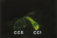 Otoferline dans les cellules sensorielles de la cochlée