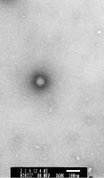 Coronavirus, agent du SRAS (syndrome respiratoire aigu sévère)