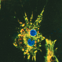 Cellules dendritiques de souris infectées par Leishmania mexicana amazonensis