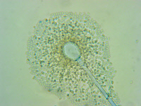 Sporocyste et endospores de Mucor circinelloides. Montage au bleu lactique.
