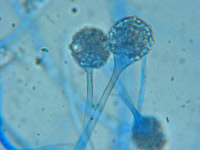 Sporocystes piriformes avec apophyse marquée de Lichtheimia corymbifera. Montage au bleu lactique.