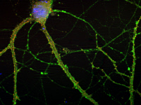 Neurone d'hippocampe de rat en culture infecté par Bornavirus